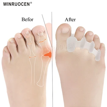 2 buc Silicon Degete Toe Toe Protector Separatoare Brancarde Îndreptat Inflamație la picior Protector Ameliorarea Durerii Picior de Îngrijire 2 Culori